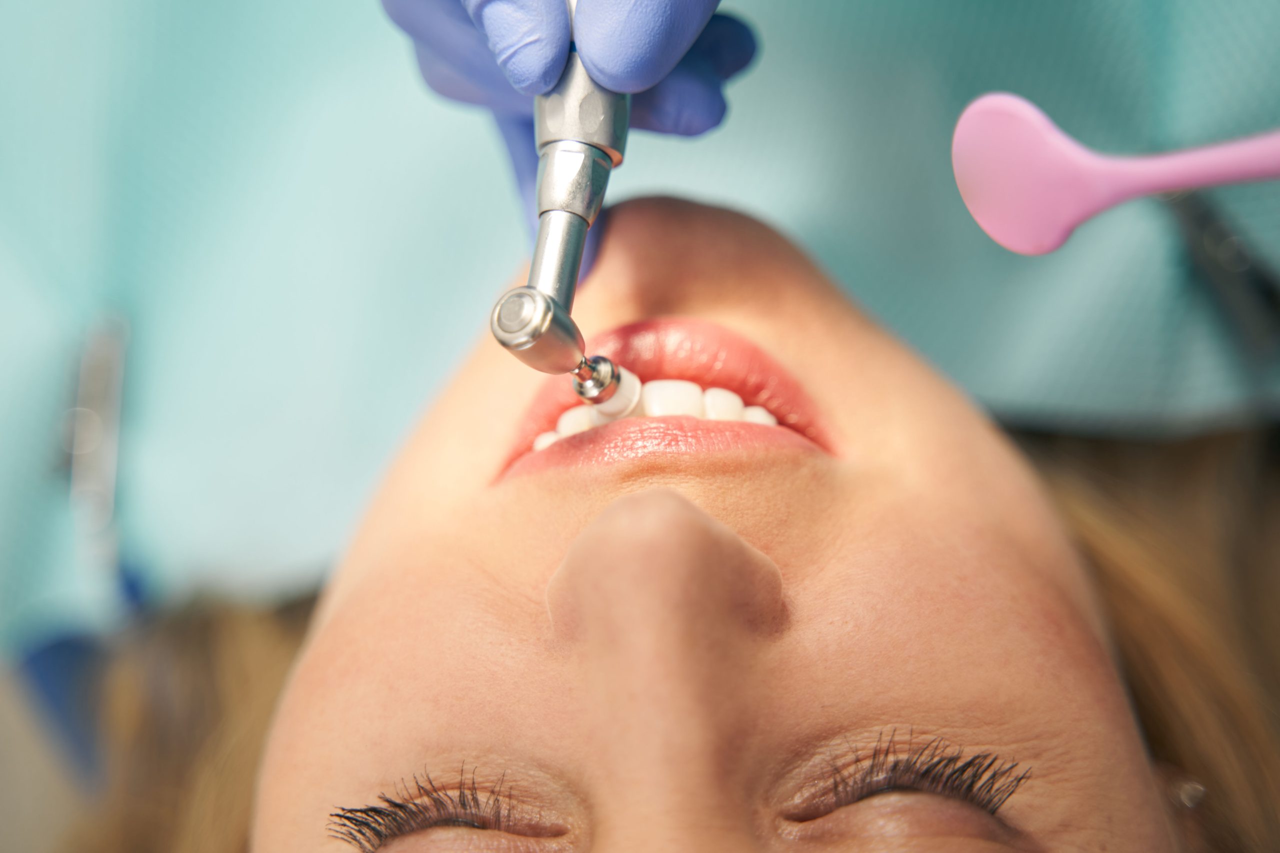 Pain After Dental Cleaning: Understanding Causes and Tips for Quick Relief