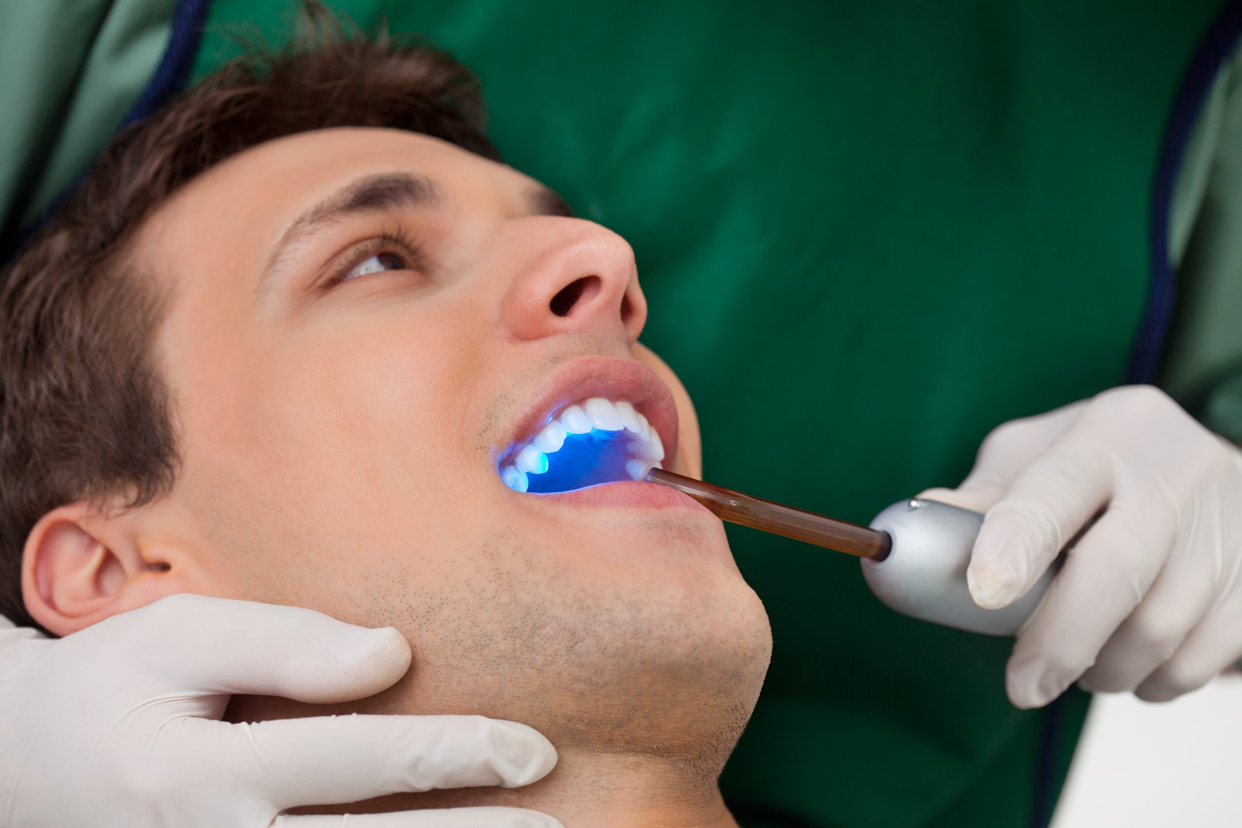 Tracing the Evolution of Dental Sealants