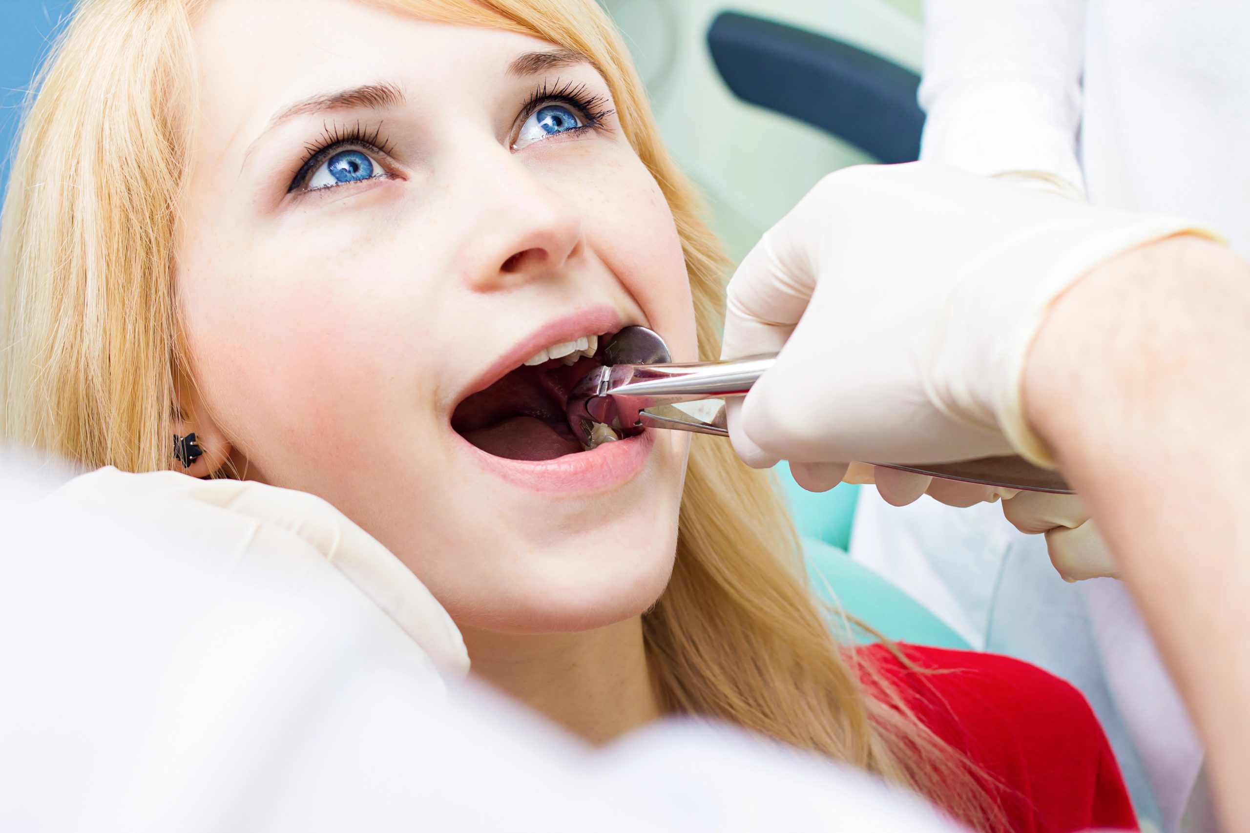 Tooth Extraction Benefits: Why It’s Necessary